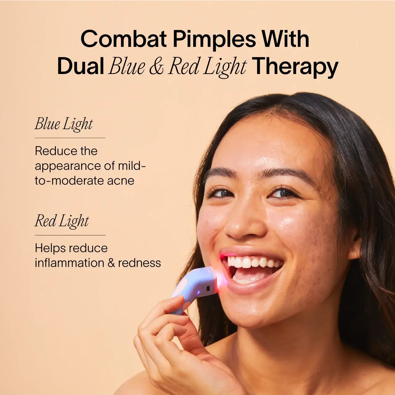 Bye Acne: 3-Minute Pimple Spot Treatment Secondary image